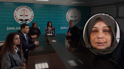 Şanlıurfa Barosu'ndan şiddet mağduru kadına destek